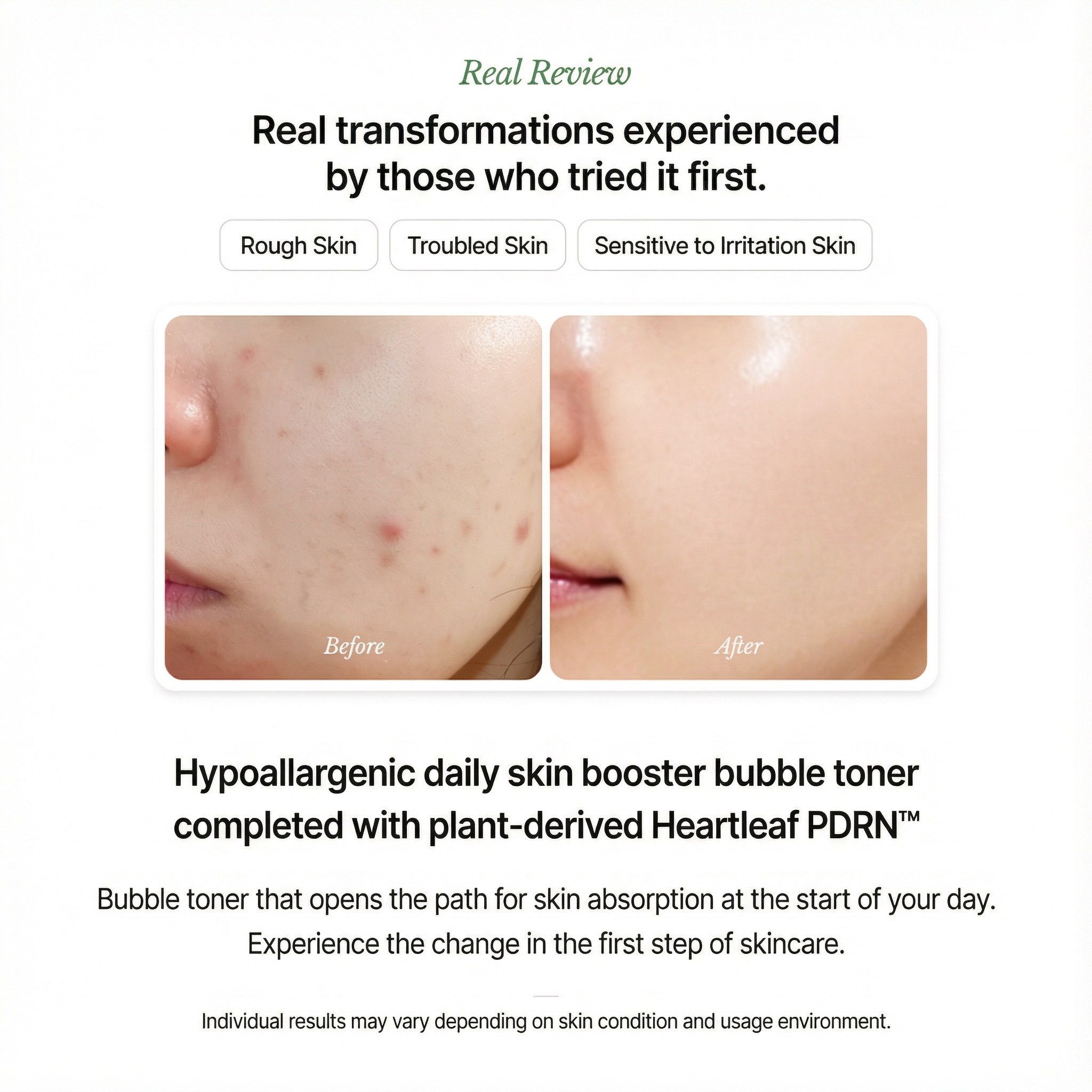 [NEW] Suelo Reju Calming PDRN Bubble Toner