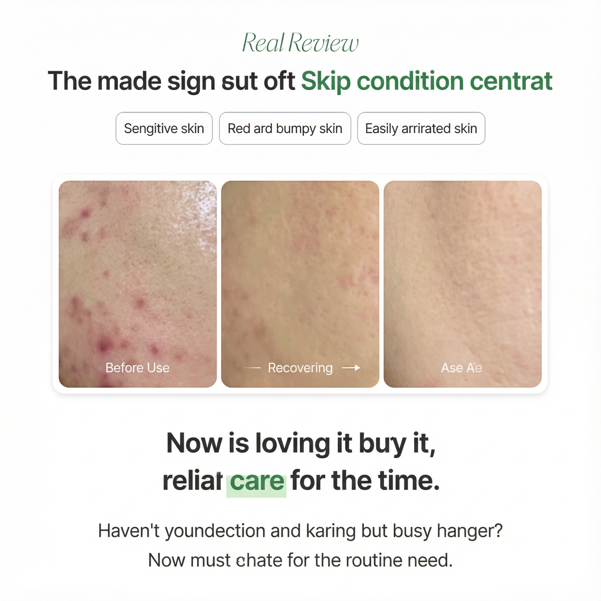 [NEW] Suelo Reju Calming PDRN Cream